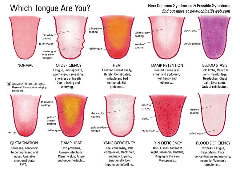 Some of the types of tongue qualities.  Note: I've lost the source of this so apologies for the lack of credit.